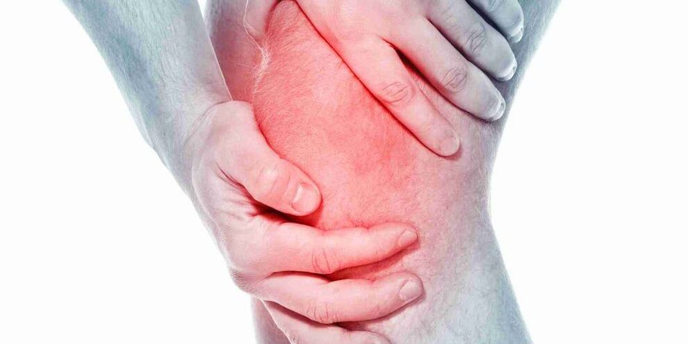 La douleur dans un genou incurvé ou droit est un symptôme pour l'arthrose de l'articulation du genou